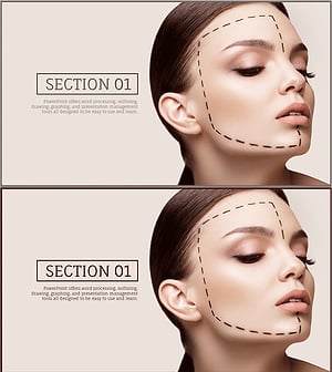 성형수술 간지 슬라이드 – 완벽한 아름다움의 추구